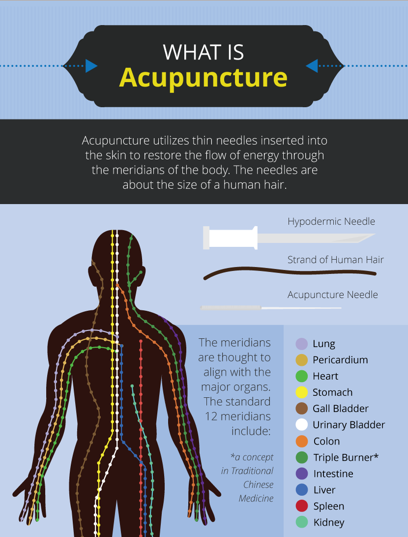 What is Acupuncture - Alternative Therapies: Benefits and Risks